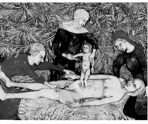 제왕절개술로 태어난 카이사르(14세기 삽화)윌리엄 세익스피어의 '줄리어스시저'에는 카이사르가 간질을 앓고 왼쪽 귀가 들리지 않는 병약한 존재로 표현하였다.