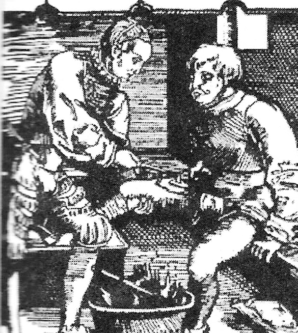 16세기 무렵 불에 달군 철로 상처를 지지는 모습. 원시적인 상처치료를 할 때 지혈의 일환으로 시행되던 치료법인데 세균 감염을 막아주지는 못한다.